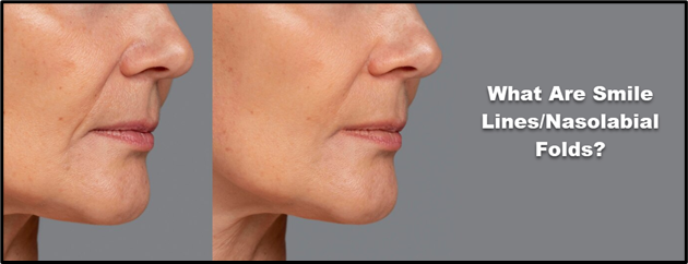 How to get rid of smile lines